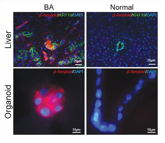 Immunohistochemistry staining